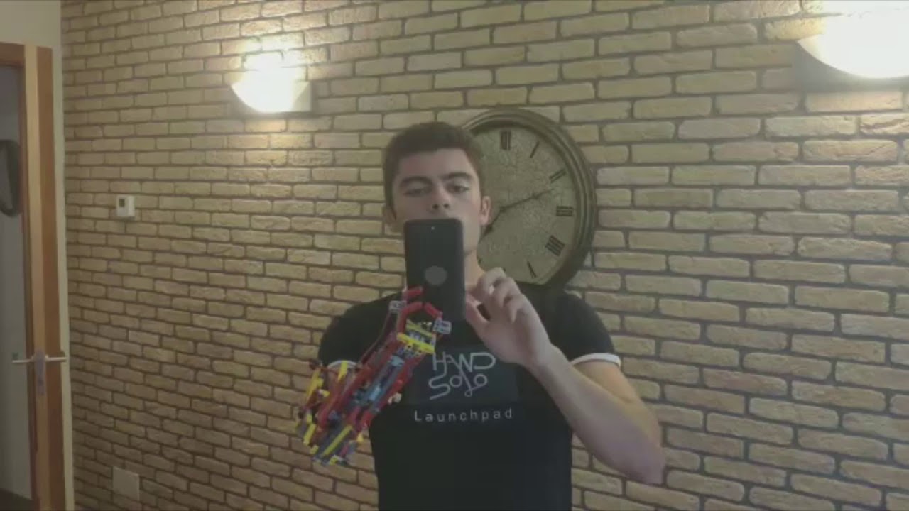 David Aguilar (HandSolo): "I am a Transhumanist since I was born"