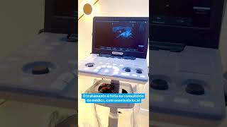 Cisto de Baker (cisto poplíteo) no joelho precisa de cirurgia?