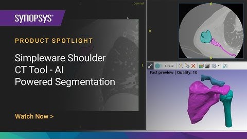 Simpleware Shoulder CT Tool - AI-Powered Segmentation | Synopsys