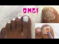 HOW TO: Fix Toe Nails With Polygel And Perfectly Gel Polish AT HOME!