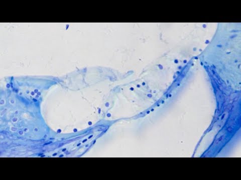 Research In The Department Of Otolaryngology Head And Neck - 