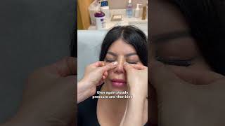 How to Tape Your Nose After Rhinoplasty | Post-Op Care with Dr. Shirley Hu