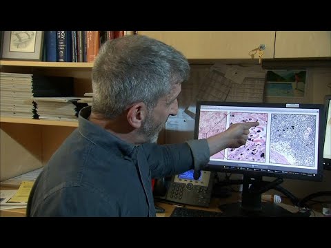 Video: Wissenschaftler Haben Ein Organ Entdeckt, Das Sich Mit Dem Einsetzen Des Alters Verjüngt - Alternative Ansicht
