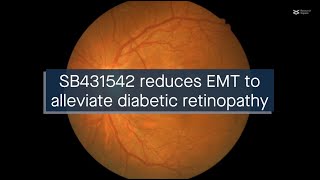 SB431542 reduces EMT in retinal pigment epithelial cells to alleviate diabetic retinopathy