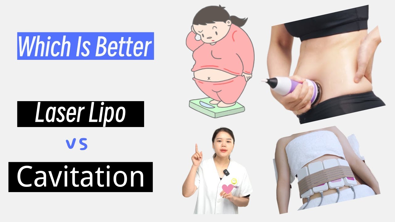 Laser Lipo vs. Ultrasonic Cavitation Which Wins the Battle of Body Contouring? YouTube
