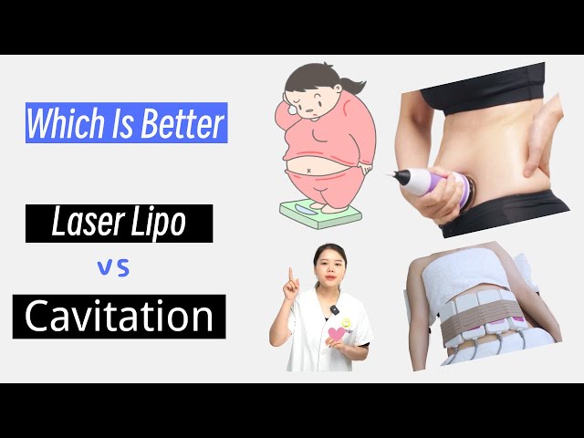 Laser Lipo vs. Ultrasonic Cavitation: Which Wins the Battle of