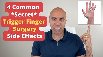 What Your Trigger Finger Surgeon Never Told You! 4 Common *Secret* Side Effects Of Surgery!