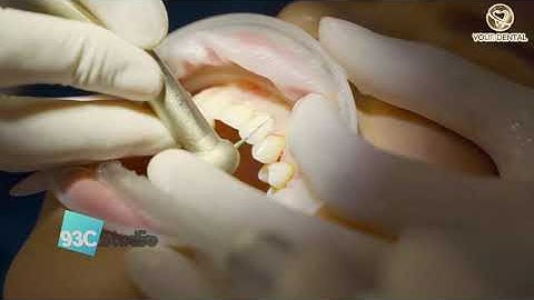 QUẢNG CÁO YOURDENTAL 2- Răng sáng nụ cười xinh, tự tin "tỏa sáng" - 93CStudio