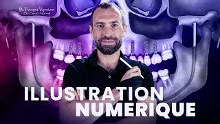 Apprendre Lillustration Numérique, Scientifique Et Pédagogique En Dentaire
