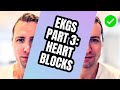 How to read ekgs like a boss part 3  heart blocks