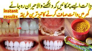 Teeth Whitening At Home/Daant Safed Karne Ka Tarika/100% Effective & Fast @theformaleditofficial