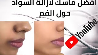 ازالة السواد حول الفم بسرعه