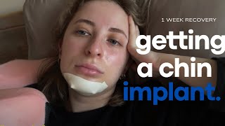 Recovering from chin implant | my experience