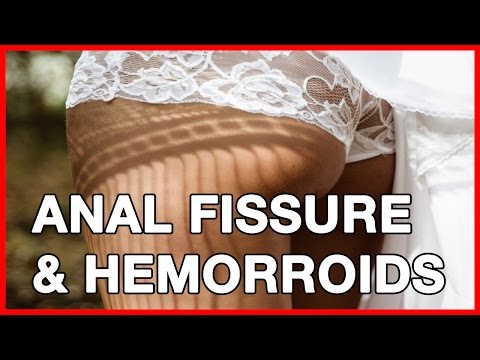 What is Anal Fissure and Hemorroids (Piles)? Treatment and Causes @HealthWebVideos