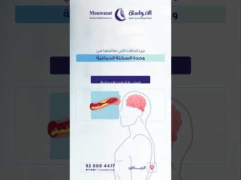 خدمات وحدة السكتة الدماغية في مستشفى المواساة بالرياض