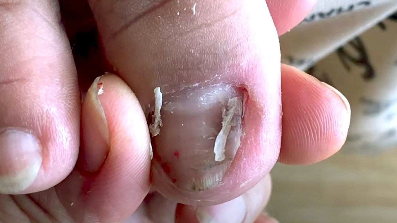 How to Repair Nails easy 348 YouTube