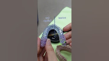 Make Your Printed Nightguard Glossy & Clear!