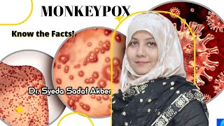 Mpox (Monkeypox).... A Viral Zoonotic Infection....