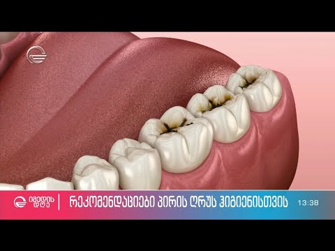 მარტივი რეკომენდაციები ჯანსაღი კბილების შესანარჩუნებლად