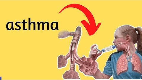 5 Natural Ways to Reduce Asthma Issues | Control Asthma | Treat Asthma at Home Easily - Healthy Bee