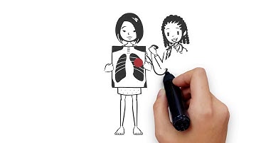 navigatER D-dimer video