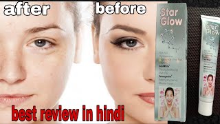 ulasan krim star glow di hindi membuat Anda cantik, menghilangkan noda dan meningkatkan trik tips kecantikan penampilan Anda