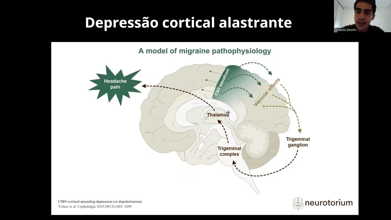 Enxaqueca (Migrânea) - Epidemiologia, fisiopatologia, quadro clínico, diagnóstico e tratamento