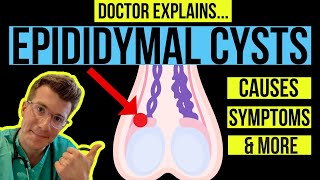 Doctor explains TESTICULAR LUMPS: PART 1 - EPIDIDYMAL CYSTS (causes, symptoms and treatments)