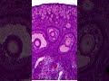 Diagram + permanent  slide of ovary  T.S ( Transverse  section)