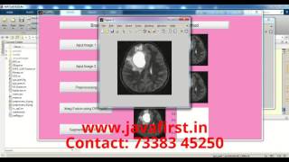 Image Fusion on Digital Images using Laplacian Pyramid with DWT