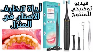 ريفيو جهاز تبيض و إزالة الجير و تصبغات الأسنان المنزلي dental tools ???