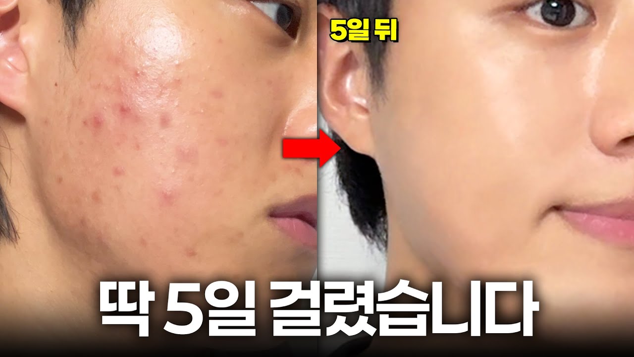 이걸 모르니까 피부 장벽이 무너지는 겁니다..❗️