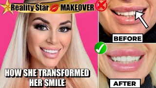 LIP FLIP or FILLER? Lip Makeover for Reality Star Marcela Iglesias from Rica Famosa Latina by Natural Injector - Emily Dowe, PA-C 2,440 views 1 year ago 6 minutes, 42 seconds