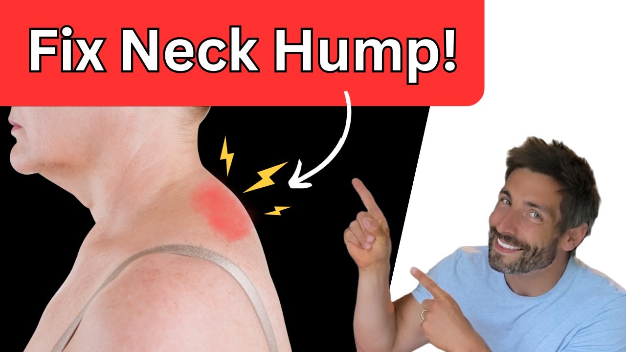 Replying to @Sasstoid How to fix your neck hump #neckhump