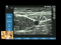Ultrasound guided obturator and saphenous nerve block workshop