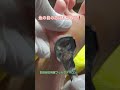 魚の目ケア【世田谷区用賀フットケア】#用賀 #フットケア #魚の目