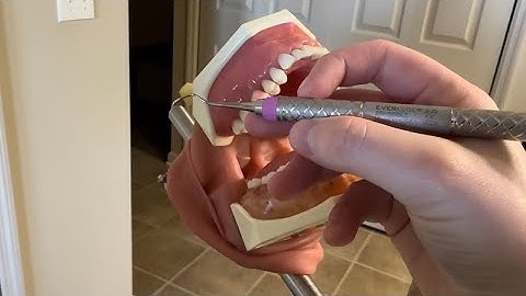 How to Use The Barnhart Universal Curet