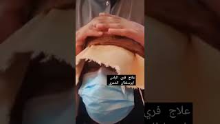 ابو سلطان الشمري  علاج فري الراس