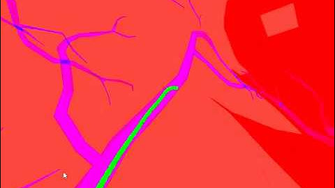 The PBD simulation of catheter