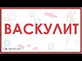 Васкулит