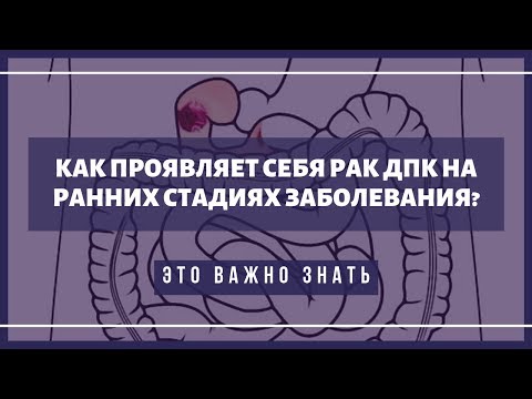 Первые симптомы рака двенадцатиперстной кишки