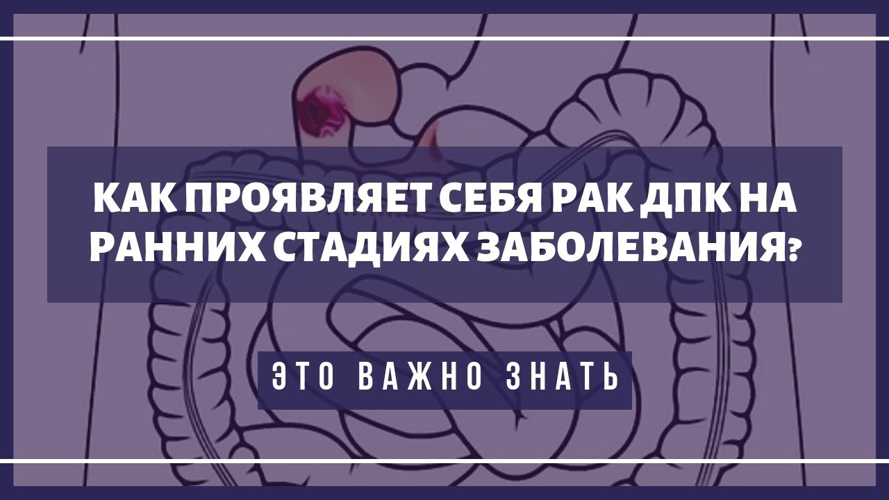 ⁣Первые симптомы рака двенадцатиперстной кишки