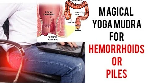 Magical Yoga Mudra to cure PILES or Hemorrhoids, Anus Fistula | Mudra for Anus related Health Issues