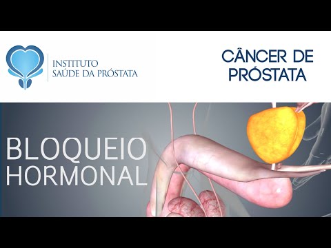 Vídeo: Câncer De Próstata: Tratamentos Hormonais Vs. Não Hormonais