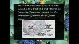 My Family Is Eds Symptom Free, Progenitor Stem Cell Signaling Pathways