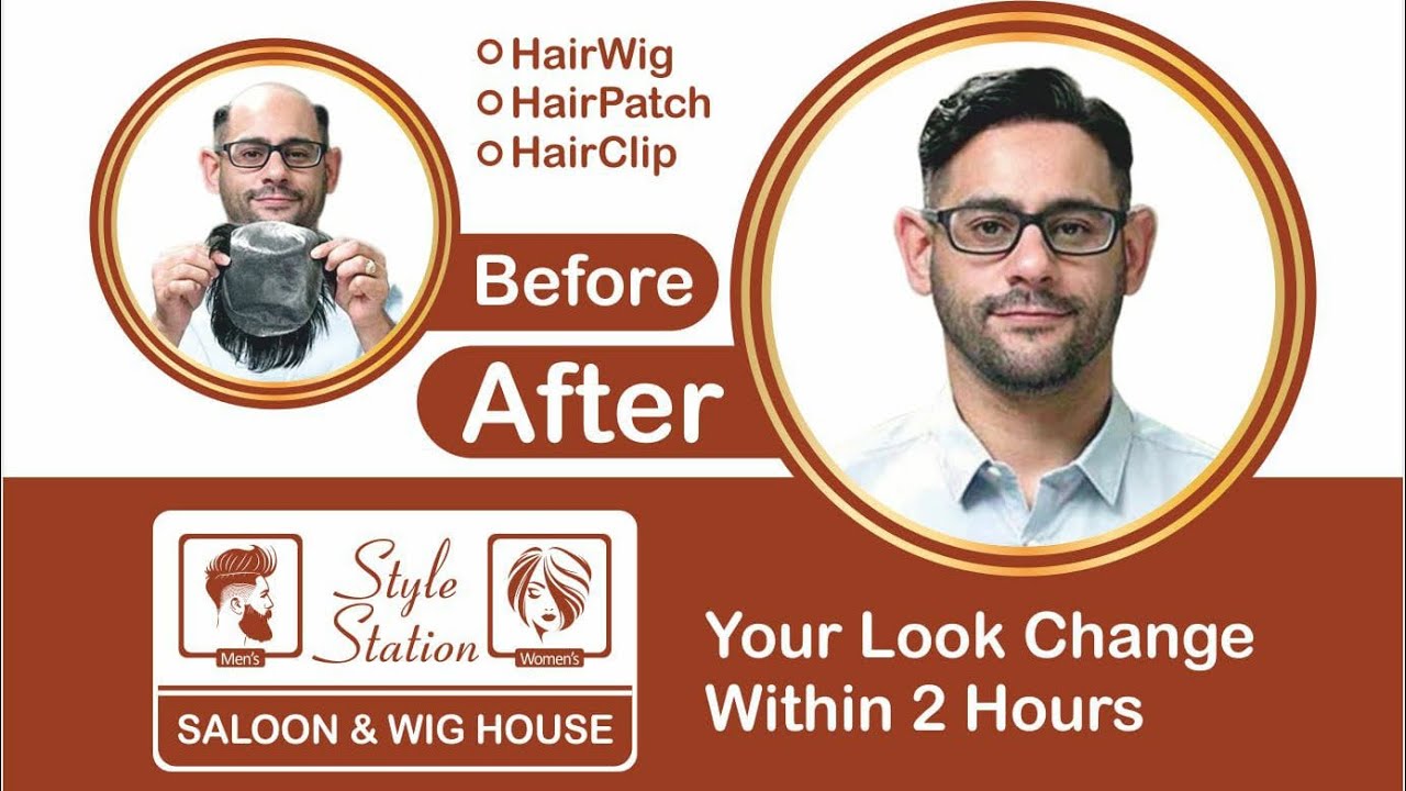 Hair Patch | Clipping | Tapping | Bonding |Fixing | Hair Replacement | in Aurangabad | 9049629049