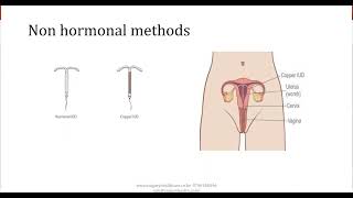 Contraception Facts Myths & Dilemmas Webinar | Calgary Healthcare