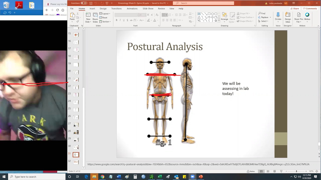 Park University FW-225 Kinesiology Unit 7 Postural Analysis 1