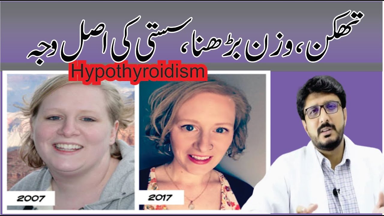 Hypothyroid symptoms What is hypothyroidism? in Urdu/Hindi