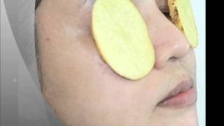 Hinchados remedios para cansados ojos y